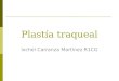 Plast­a traqueal