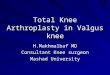 Total Knee Arthroplasty in Valgus knee
