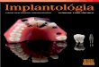 Implantológia 2010. 2. szám