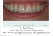Dental Implant Case Book 1. Gate Clinic