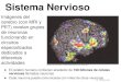 Sistema Nervioso (Monterrubio)