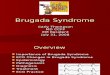 Brugada Syndrome ECG