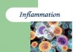 Inflammation. Definition Inflammation is biochemical, structural and cellular non-specific protective process occurring locally in vascularized tissues
