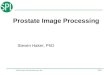 ©2005 Surgical Planning Laboratory, ARR Slide 1 Prostate Image Processing Steven Haker, PhD