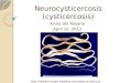Neurocysticercosis (cysticercosis) Krizia del Rosario April 12, 2012 