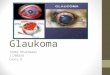 Presentasi Glaukoma
