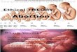 Abortion Ethical Issue