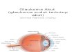 Glaukoma Akut Cae