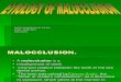 56241260 Etiology of Malocclusion (1)