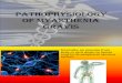 Pathophysiology of Myasthenia Gravis