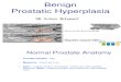 Benign Prostatic Hyperplasia Ggb