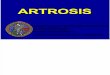 14.2 - Artrosis (Cont)