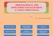 Imaging in Bronchogenic Carcinoma