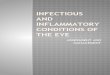 Infectious and Inflammatory Conditions of the Eye NCM 105
