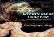 Diverticulosis%5B1%5D %5BAutosaved%5D[1]