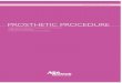 Prosthetic guide 151207