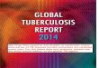 Global tuberculosis report 2014