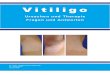 Vitiligo - Ursachen und Therapien - Fragen und Antworten