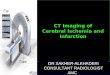CT Imaging of Cerebral Ischemia and Infarction