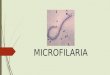 Microfilariae (Wuchereria Bancrofti)
