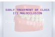 early treatment of class III malocclusion