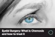 Eyelid surgery: What is chemosis and how to treat it