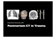 Postmortem CT (PMCT)