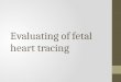 Evaluating of fetal heart tracing
