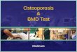 Osteoporosis & BMD Test