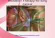 Radiation therapy for lung cancer