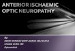 AION Anterior Ischemic Optic Neuropathy