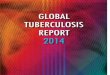 Global tuberculosis 2014