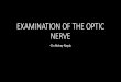 Examination of the optic nerve