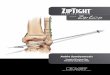ZipTight Fixation System for Ankle Syndesmosis Surgical Technique 