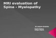 Mri evaluation of spine myelopathy
