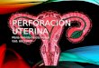 perforacion uterina