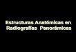 Estructuras en Panorámicas - Práctica Revisión 2013
