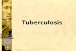 Kapag hindi napagtibay ang pagsugpo ng TB