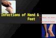 Hand & Foot infections
