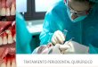 Tratamientos periodontales quirúrgicos