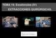 Exodoncias (IV)