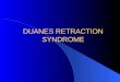 Duanes retraction syndrome