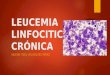 Actualizaciones Leucemia Linfocitica Cronica 2016