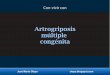 Artrogriposis múltiple congénita