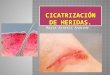 Cicatrización de heridas cirugia. maria asteria