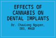 Effects of Cannabis on Dental Implants