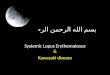 Systemic lupus erythematosis & Kawasaki disease