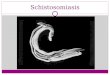 Genitourinary Schistosomiasis