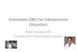 Frameless DBS For Movements Disorders