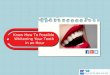Know How To Possible Whitening Your Teeth in an Hour